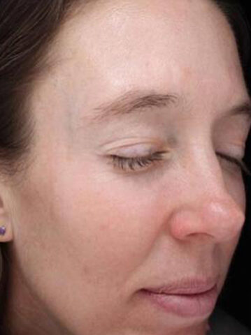 Case # 20 after photo