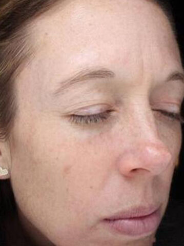 Case # 20 before photo