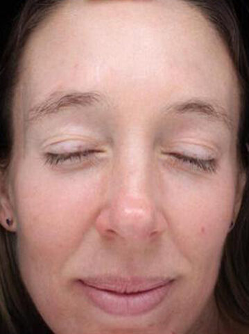 Case # 20 after photo