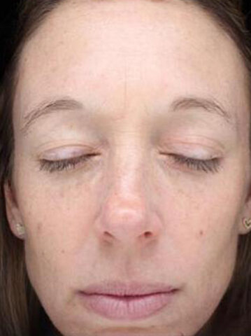 Case # 20 before photo