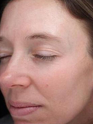 Case # 20 after photo