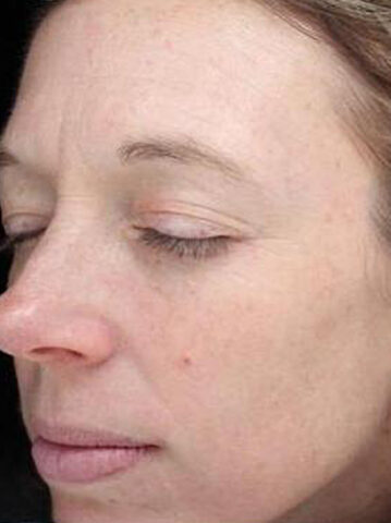 Case # 20 before photo