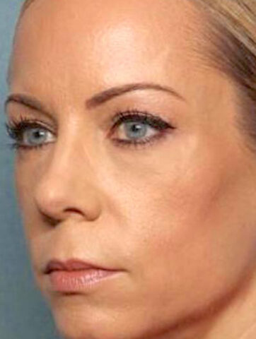 Case # 6 after photo