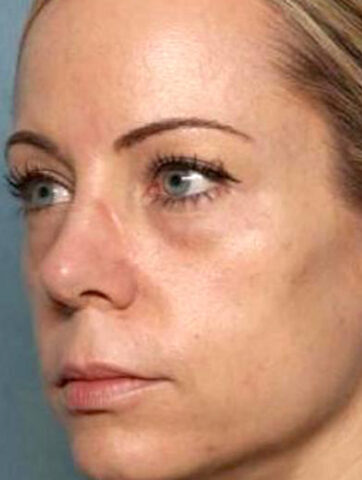 Case # 6 before photo