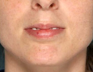 Case # 11 before photo