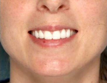 Case # 11 before photo