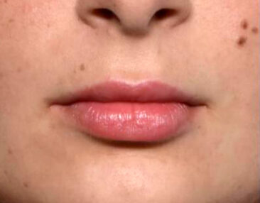 Case # 10 after photo