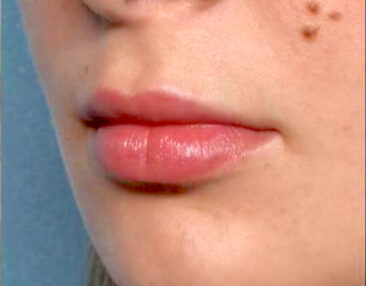 Case # 10 after photo