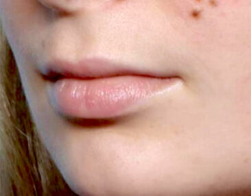 Case # 10 before photo