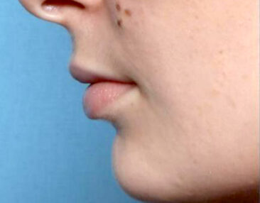 Case # 10 before photo