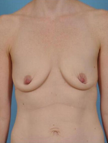 Case # 22 before photo