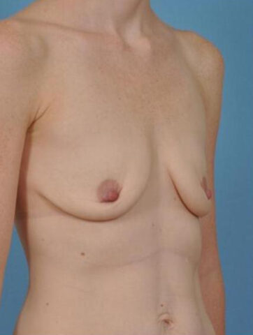 Case # 22 before photo