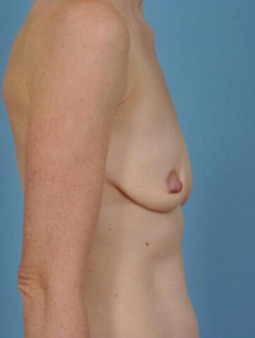 Case # 22 before photo