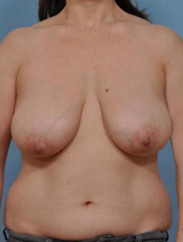 Case # 3 before photo