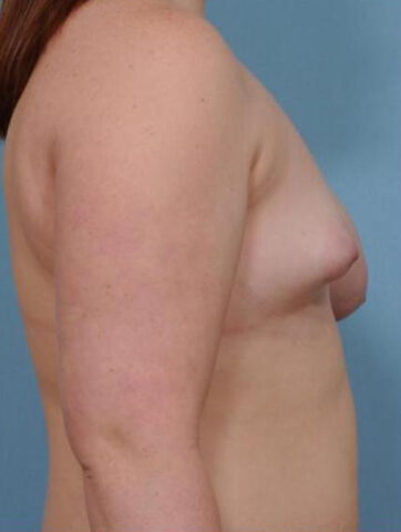 Case # 1 before photo