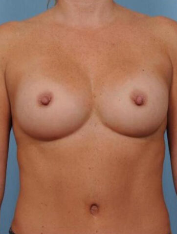 Case # 2 after photo