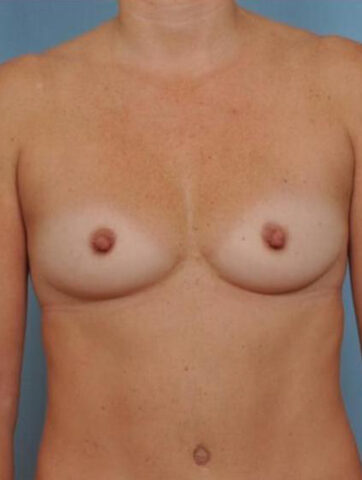 Case # 2 before photo