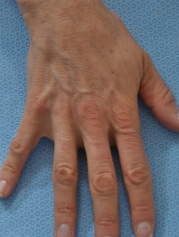 Case # 2 before photo