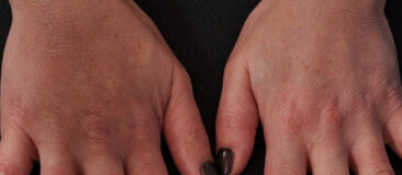 Case # 3 after photo