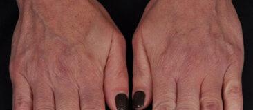 Case # 3 before photo