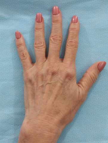 Case # 1 before photo