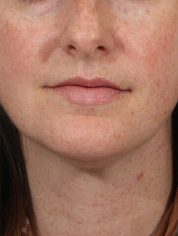 Case # 1 before photo