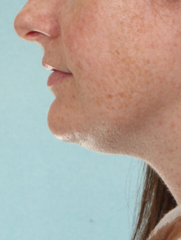 Case # 1 before photo