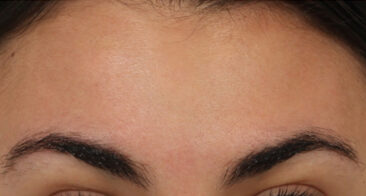 Case # 5 after photo