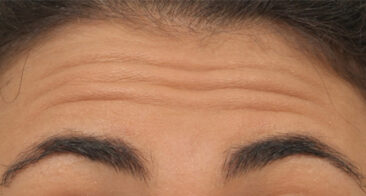 Case # 5 before photo