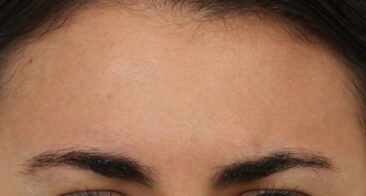 Case # 5 after photo