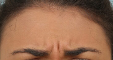 Case # 5 before photo