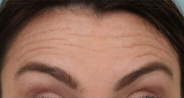 Case # 4 before photo