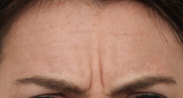 Case # 4 before photo