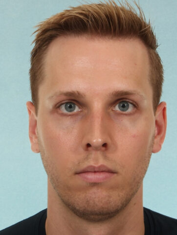 Case # 4 before photo