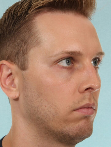 Case # 4 before photo