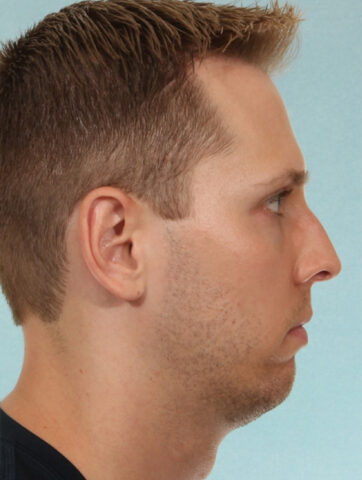 Case # 4 before photo