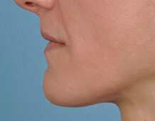 Case # 8 before photo