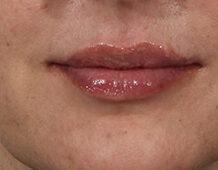 Case # 7 after photo