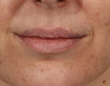 Case # 7 before photo