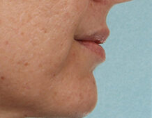 Case # 7 before photo