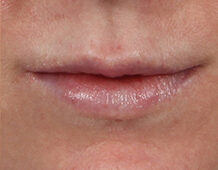 Case # 19 after photo