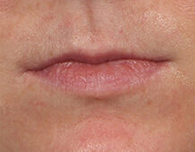 Case # 19 before photo