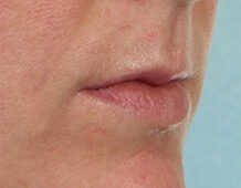 Case # 19 before photo