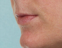 Case # 19 before photo