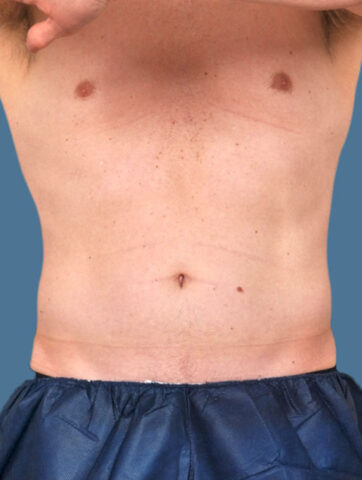 Case # 20 after photo