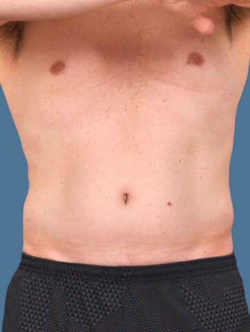 Case # 20 before photo