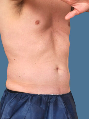 Case # 20 after photo