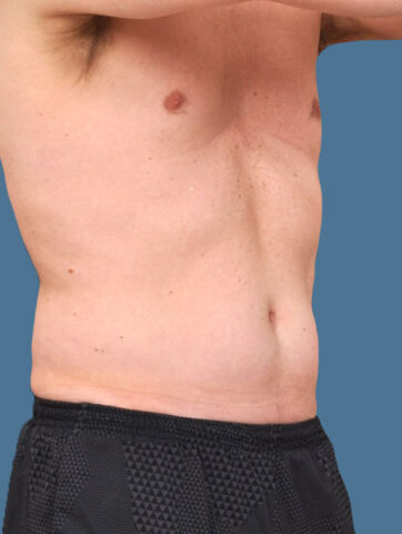 Case # 20 before photo