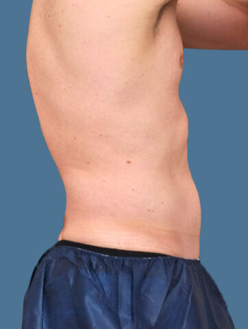 Case # 20 after photo