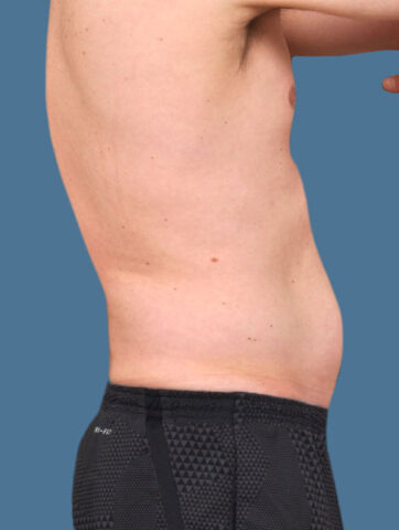 Case # 20 before photo